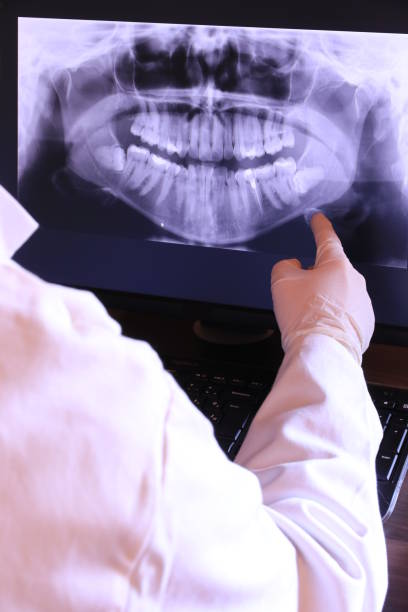 Best Broken or Cracked Tooth Emergency Dentist in Oak Harbor, WA